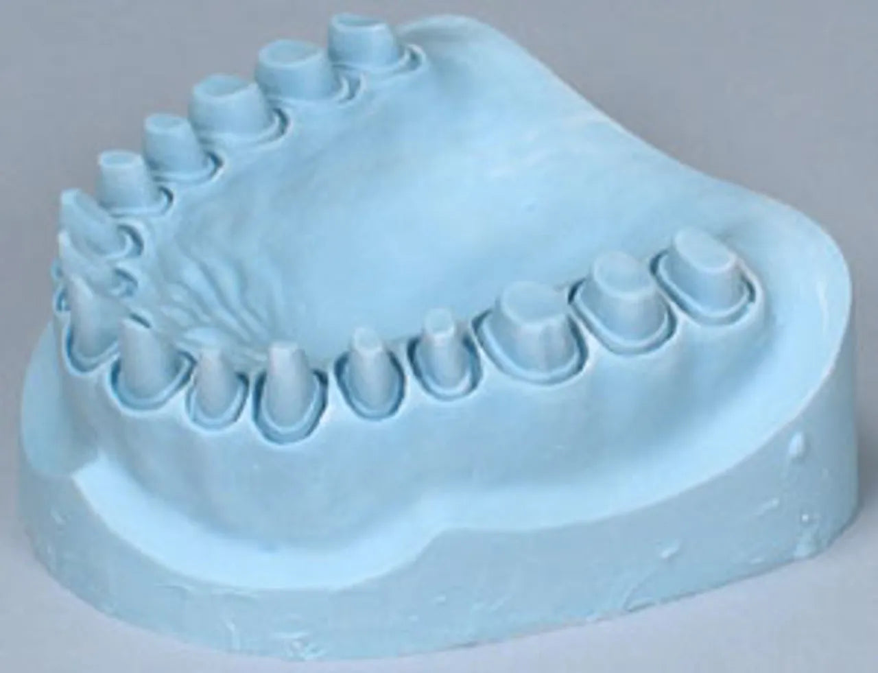 Kalabhai Ultra Stone