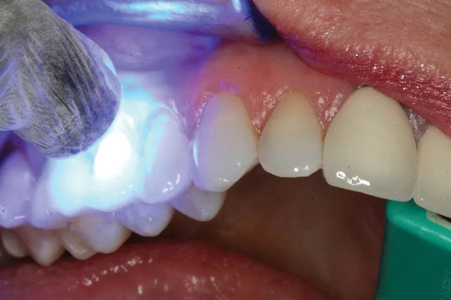 Prevest DenPro Fusion Nano Coat