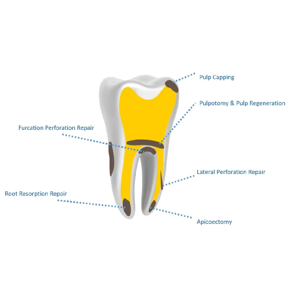 Kids-e-Dental e-lodocal calcium
