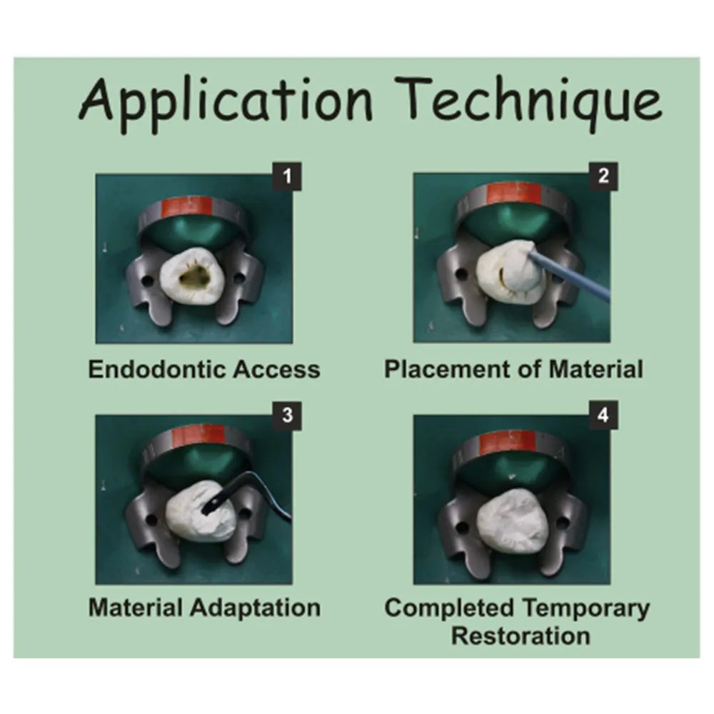 Prevest DenPro Orafil G
