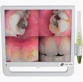 Intra Oral Camera+Monitor