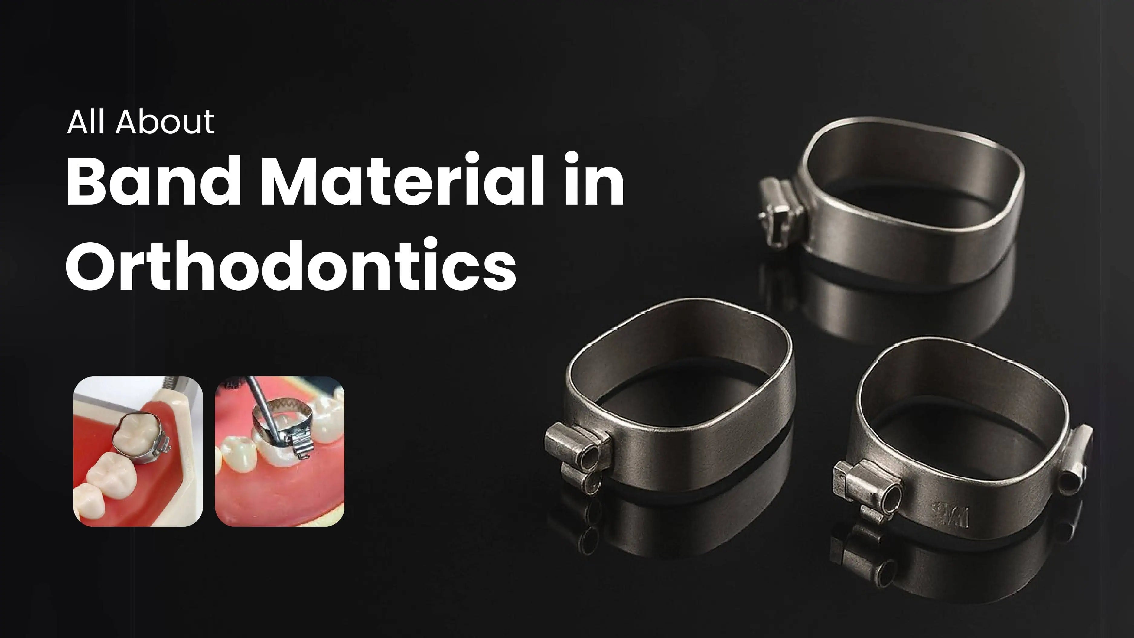 All About Band Material in  Orthodontics