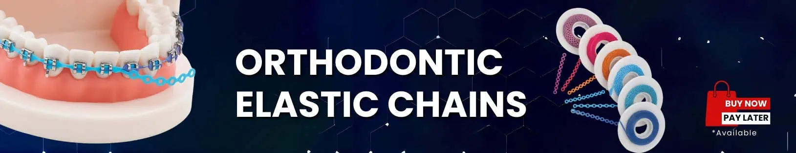 Elastic Chains