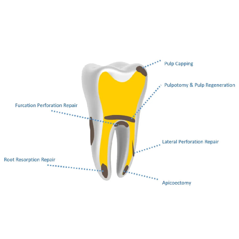Kids-e-Dental e-lodocal calcium