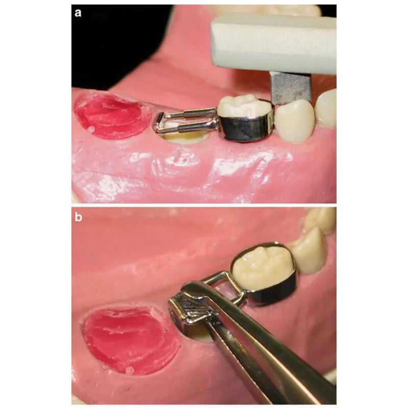 Kids-e-Dental Distal Shoe Loops