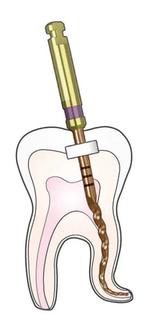 Woodpecker EndoPlus Heat Treated Gold Rotary Files