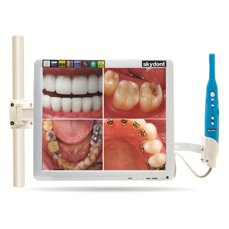 Skydent Intra Oral Camera